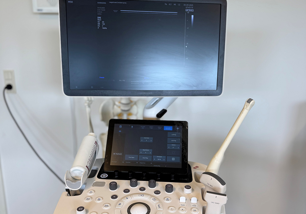 Flere patienter kan få ultralyd hos egen læge i Region Sjælland