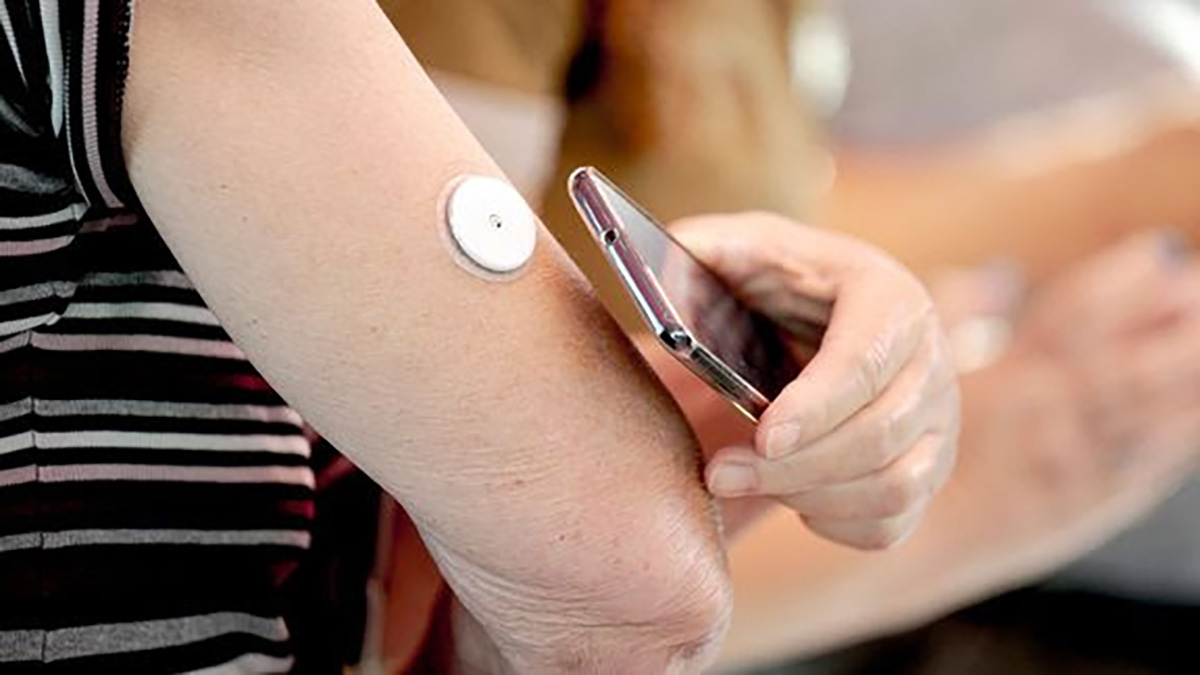 Kun få med type 2-diabetes har adgang til moderne sensorer